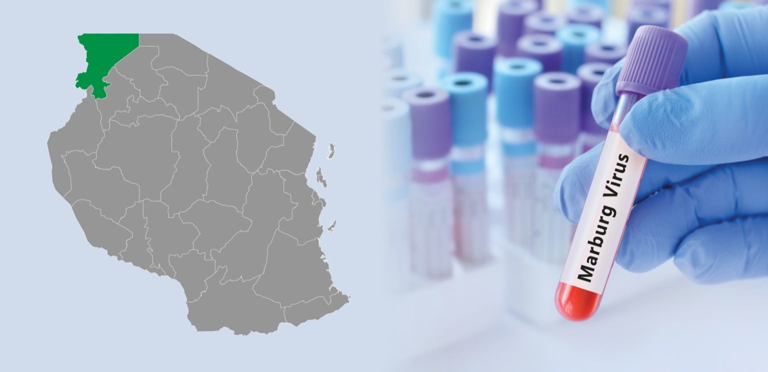 Marburg virus disease
